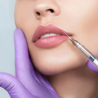 Perfilado labial