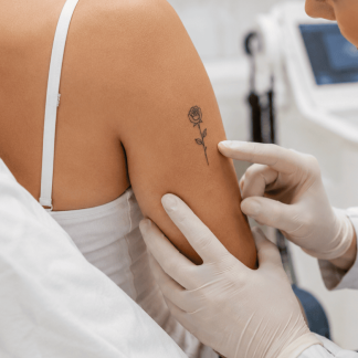 Eliminación de tatuajes