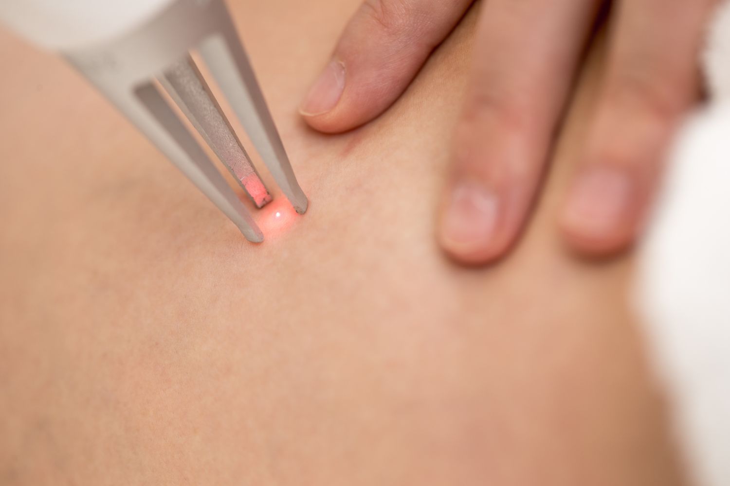 tecnologia-dermatologia