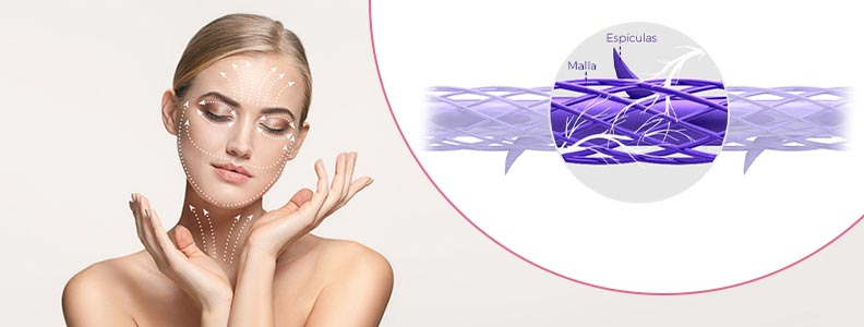 Lifting sin cirugía con las nuevas mallas de retensado facial Tesslift Soft