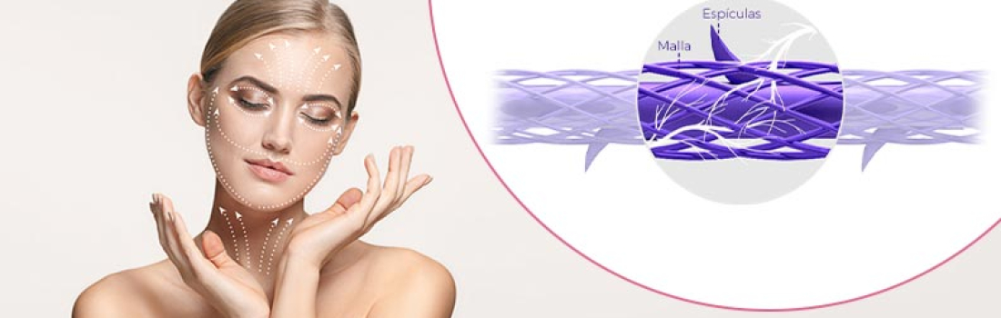 Lifting sin cirugía con las nuevas mallas de retensado facial Tesslift Soft