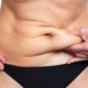 Tirzepatida para el tratamiento de la obesidad: cómo funciona y cuándo está indicada